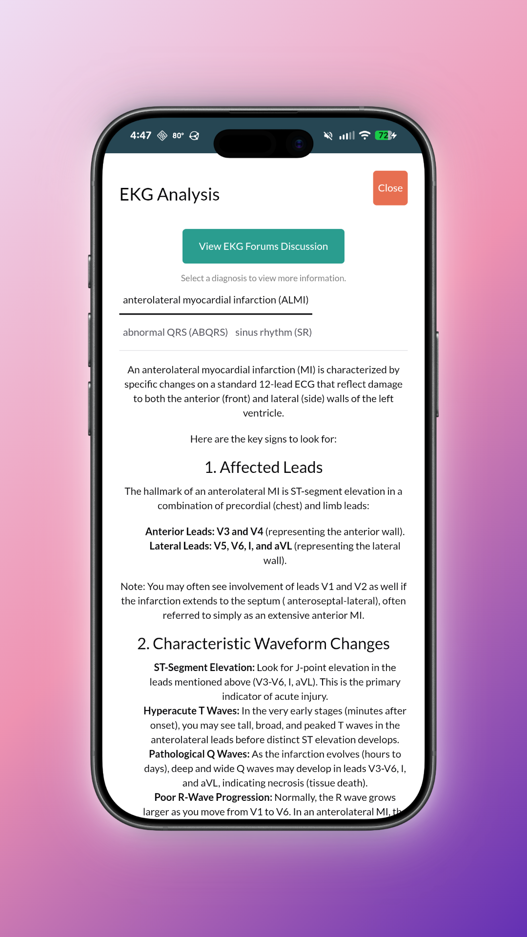 EKG Battle App Screen 4