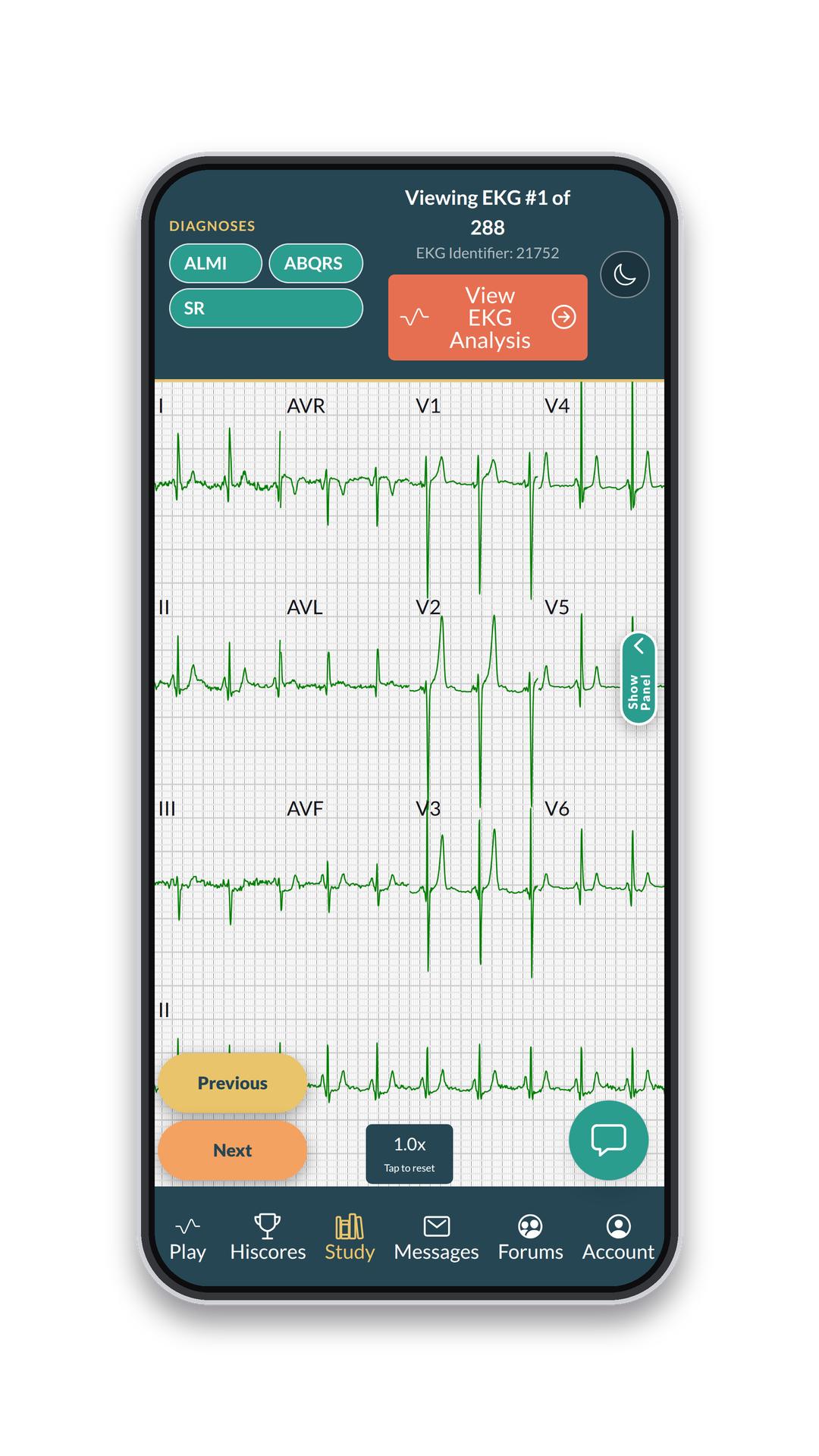 EKG Battle app — study screen